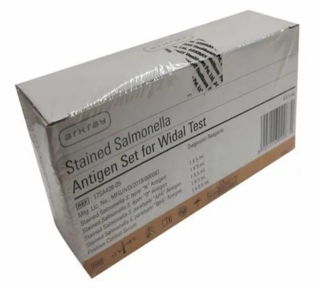 stained-salmonella-antigen-set-widal-test-500x500